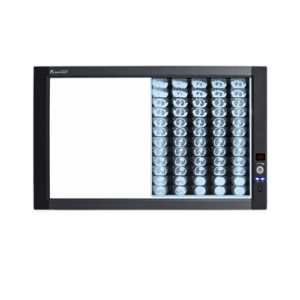 Negatoscopio Ultradelgado LED